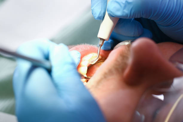 Best Emergency Dentist for Knocked-Out Tooth in Kelseyville, CA